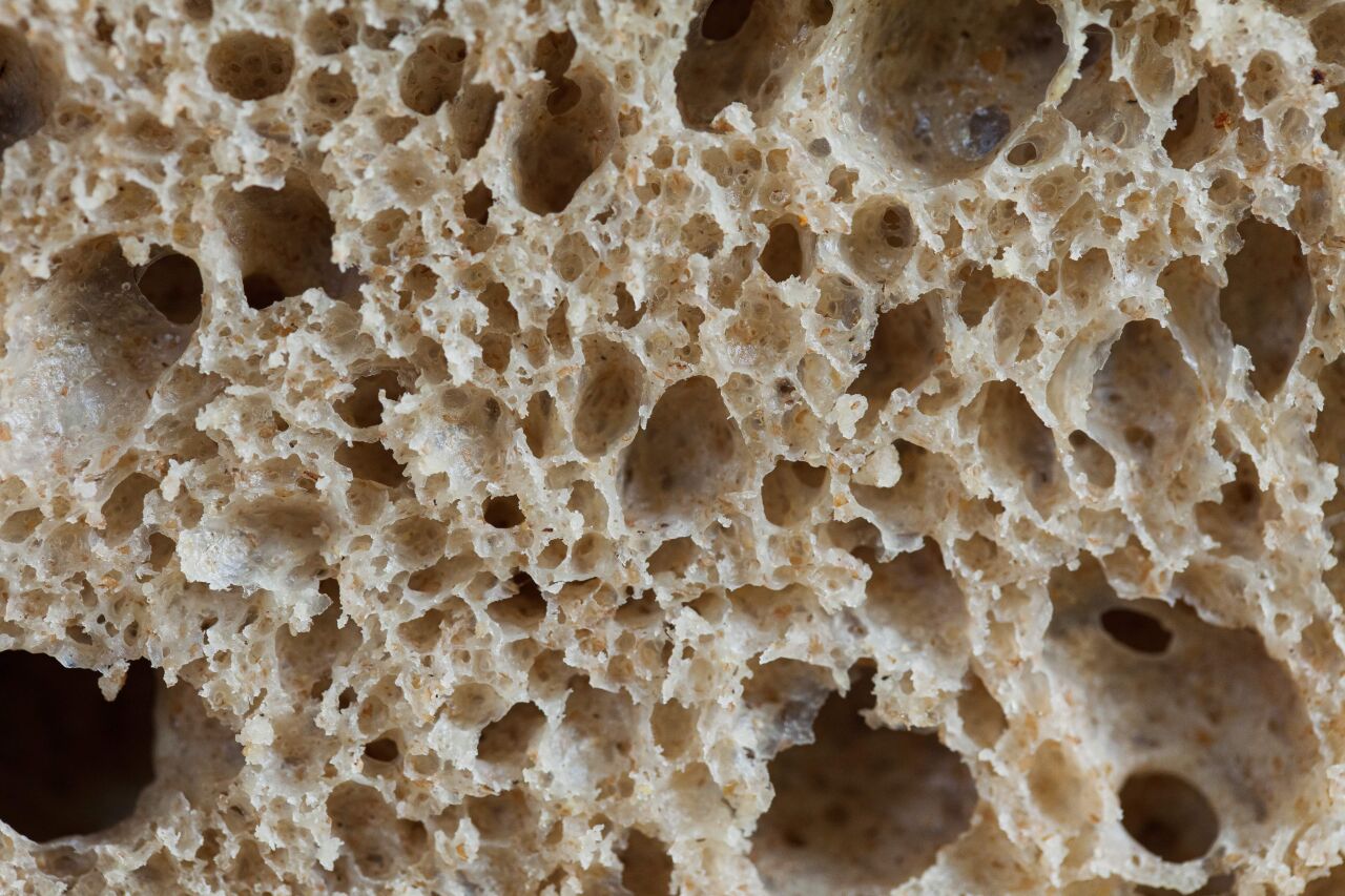 Gluten Nedir? Sağlığımız üzerindeki etkileri nelerdir?